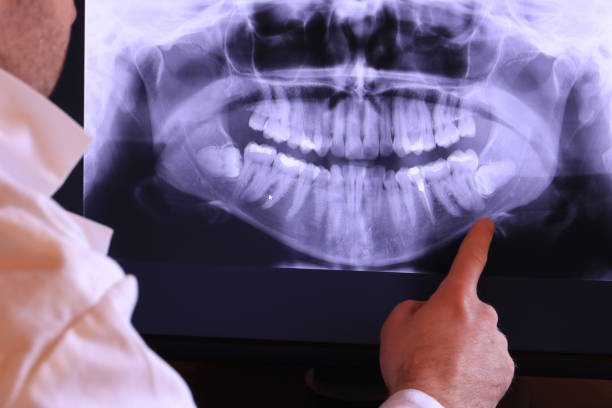 Best Broken Tooth Emergency  in Tullytown, PA
